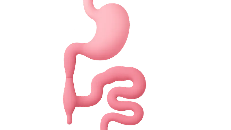 Gastrointestinal malformations