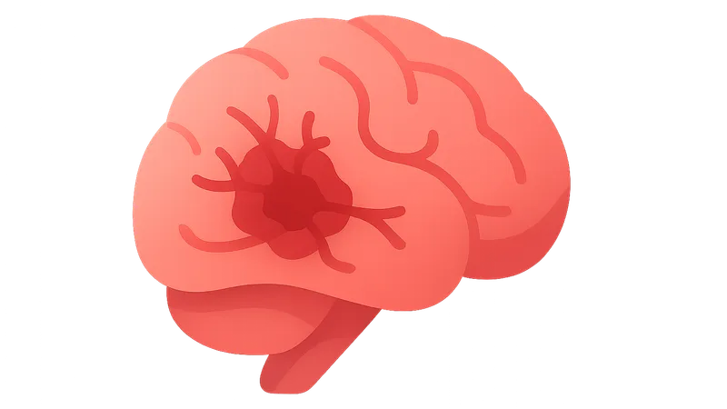 Hemorrhagic stroke management