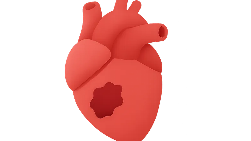 Myocardial infarction pathology