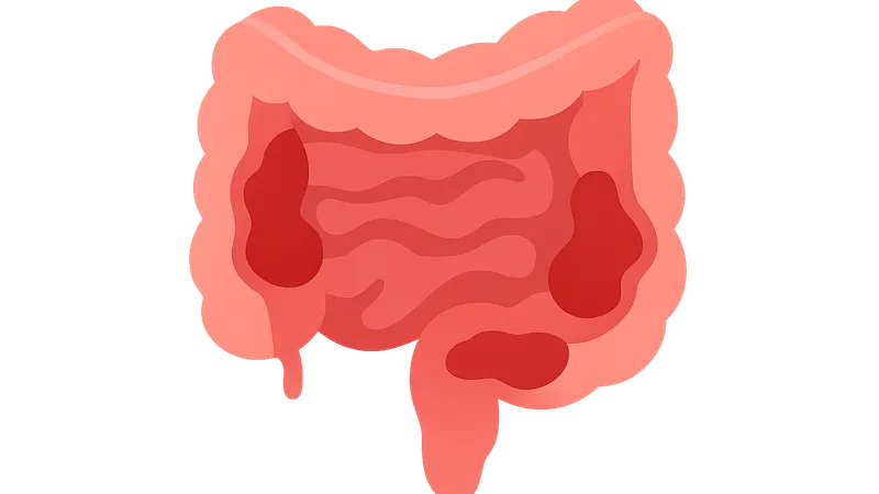 Inflammatory bowel diseases