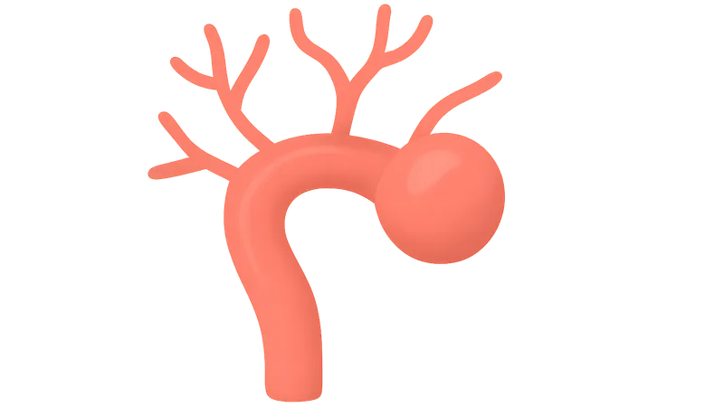 Cerebrovascular Diseases