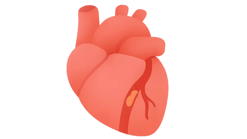 NSTEMI diagnosis and management
