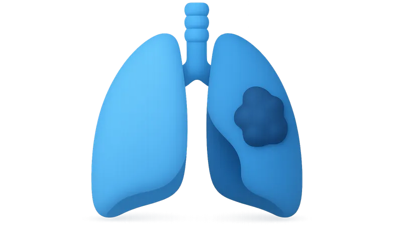Altered compliance in disease states
