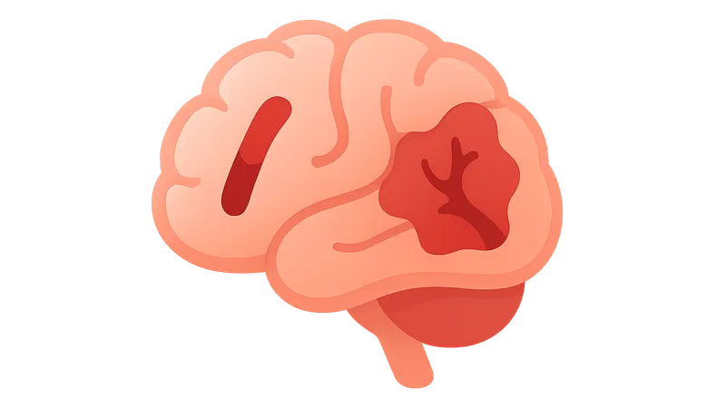 Ischemic vs hemorrhagic stroke differentiation