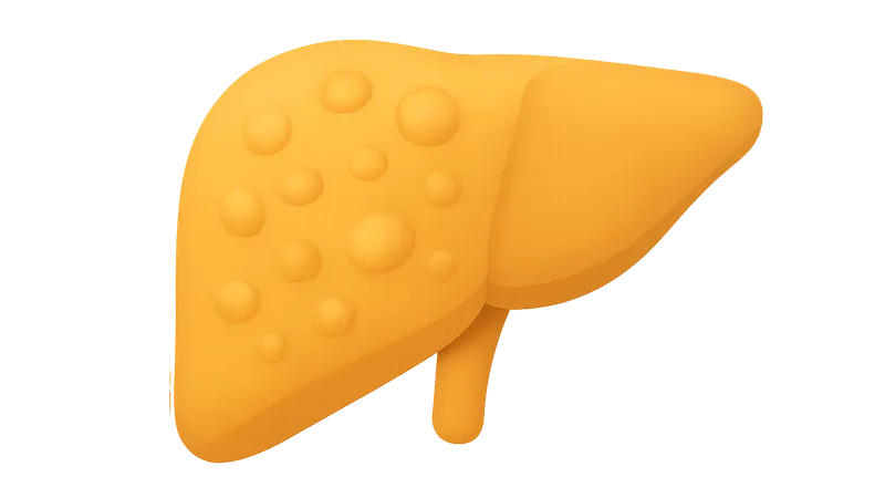 Disorders of lipid metabolism