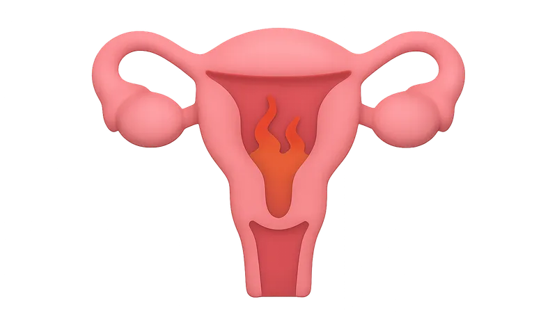 Primary Dysmenorrhea