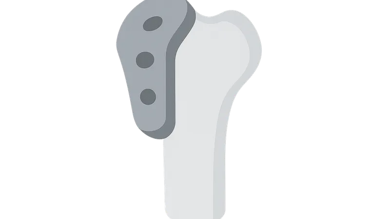 Orthopaedic Biomaterials