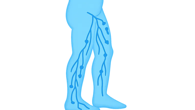 Lower limb lymphatic drainage