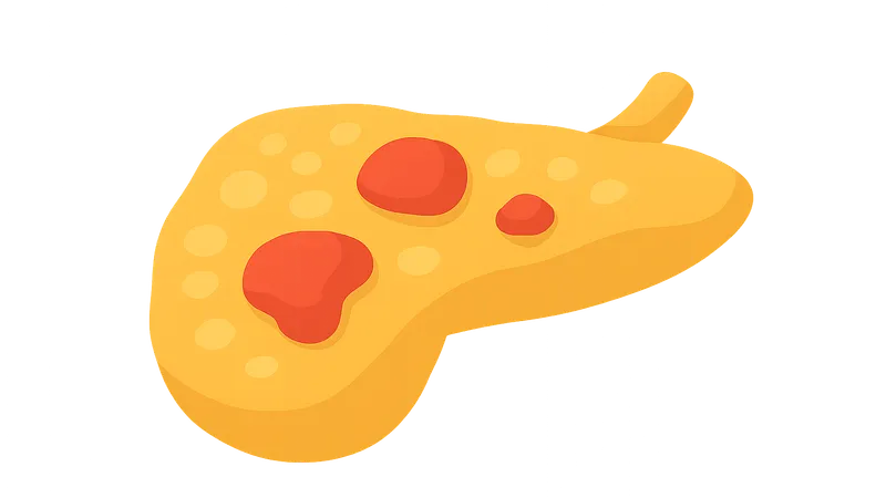 Acute pancreatitis etiology