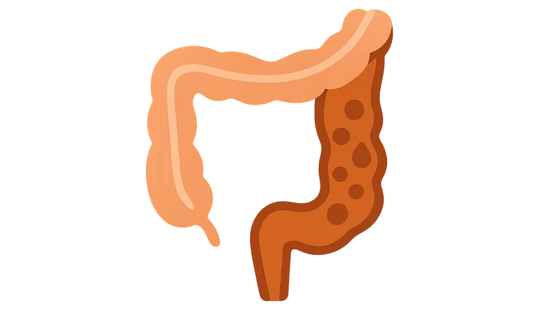 Medical management of Crohn's disease
