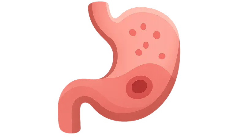 Gastritis and peptic ulcer disease