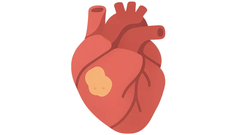 ACS pathophysiology and classification