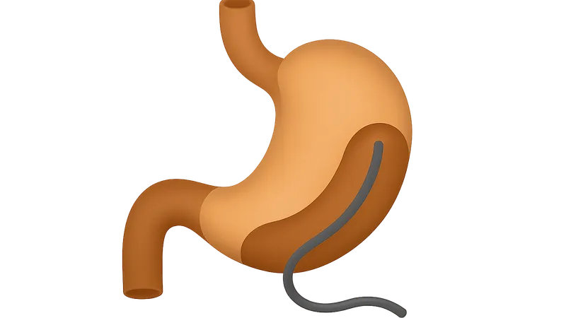 Gastrointestinal Interventions