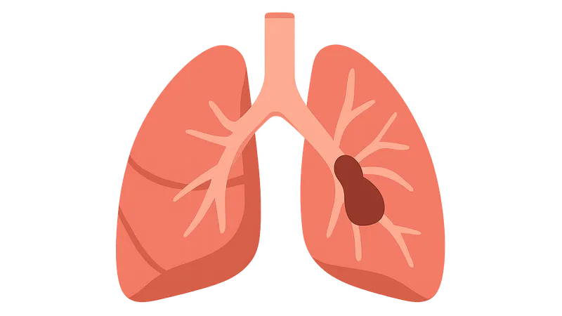 Pulmonary Vascular Diseases