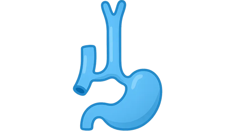 Esophageal Atresia and Tracheoesophageal Fistula