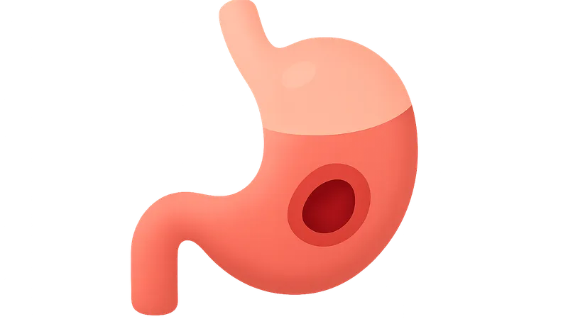 Peptic Ulcer Disease