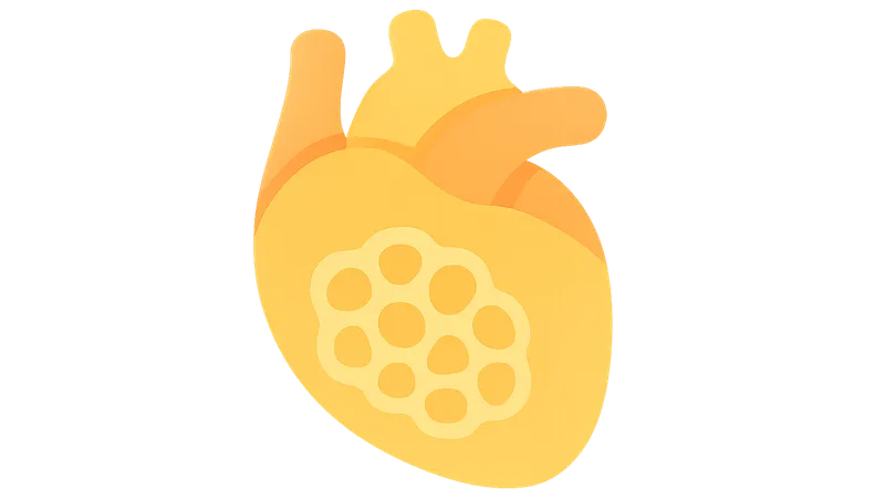 GSD type II (Pompe disease)