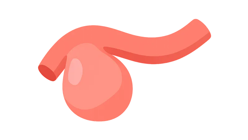 Coronary artery aneurysms