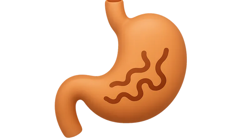 GI motility disorders