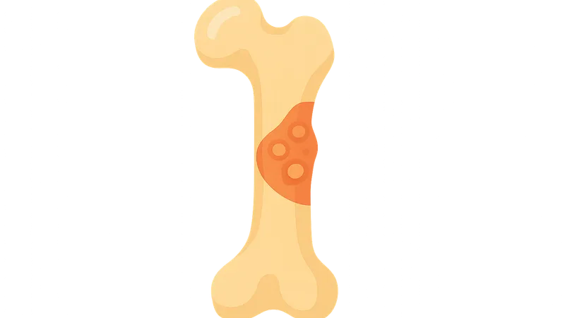 Bone and Joint Infections