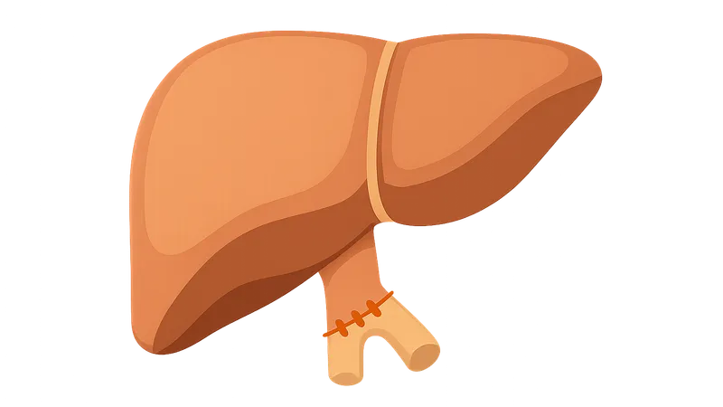 Liver transplantation