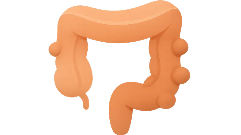 Diverticular disease