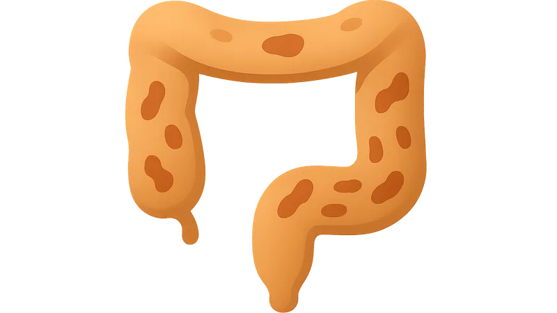 Medical management of ulcerative colitis