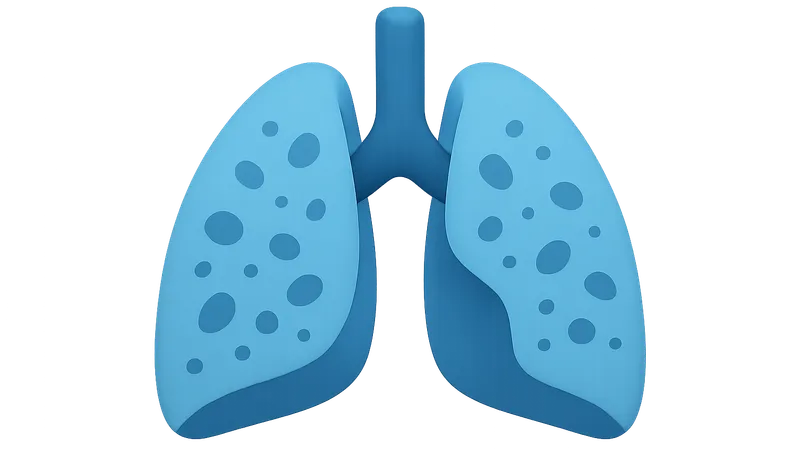 Interstitial Lung Diseases