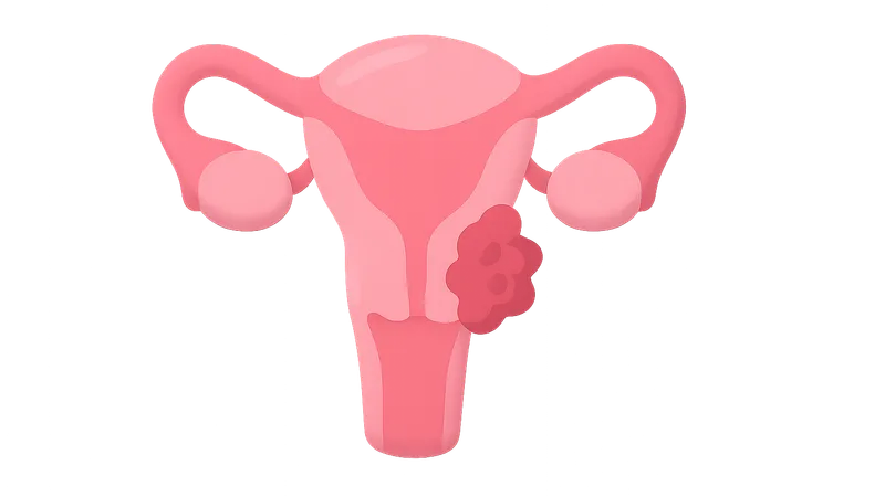 Gynecologic Oncology