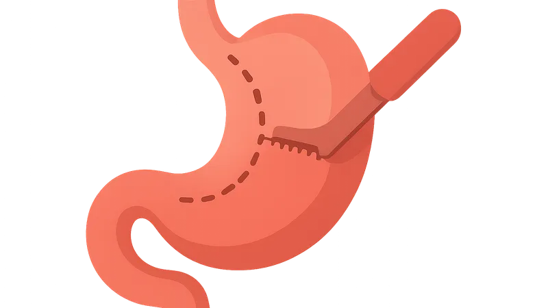 Gastric surgery procedures