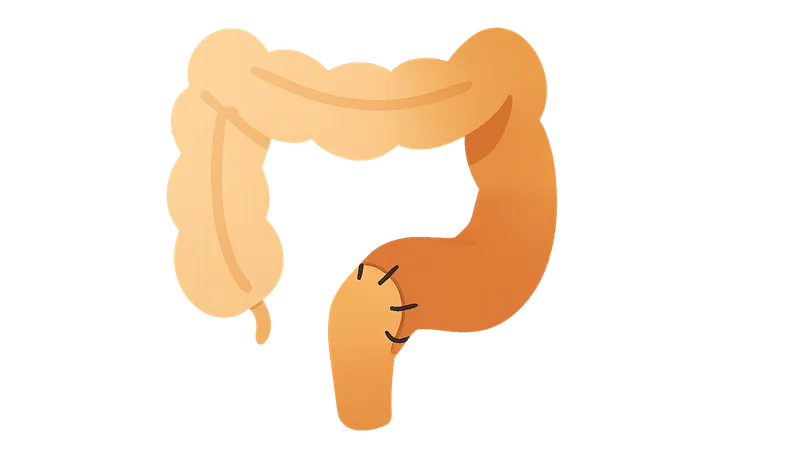 Elective colorectal procedures