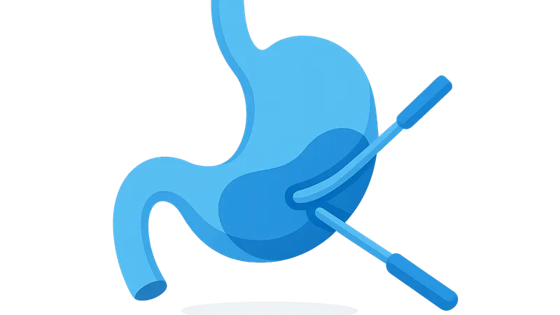 NOTES (Natural Orifice Transluminal Endoscopic Surgery)