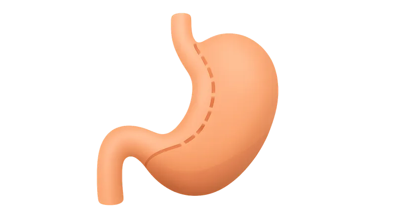 Metabolic Effects of Bariatric Surgery