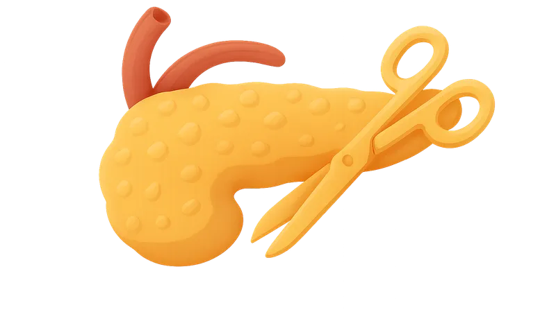 Pancreatic Surgery