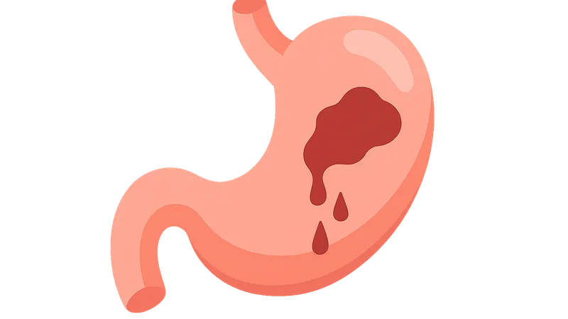 Gastrointestinal Bleeding