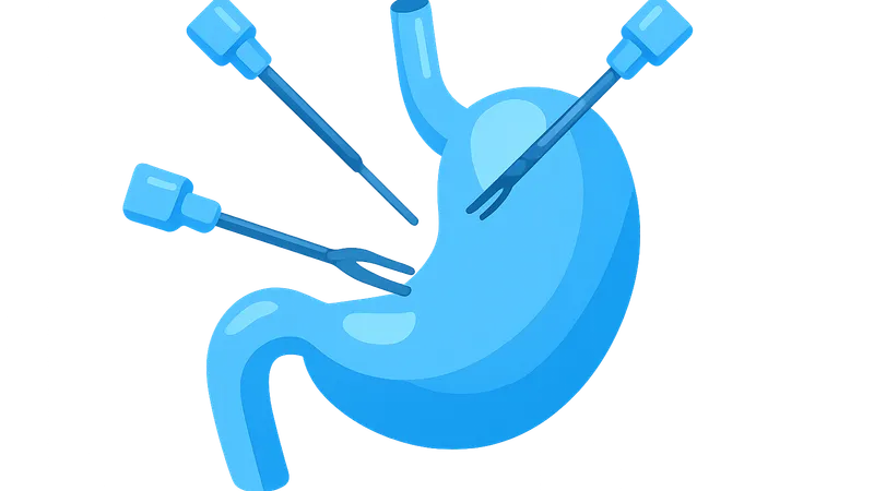 Laparoscopic Upper GI Surgery