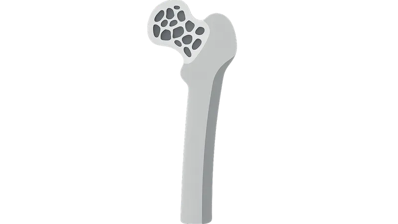 Metabolic Bone Diseases