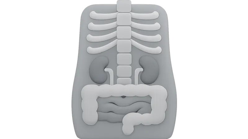 Radiographic Anatomy of Abdomen