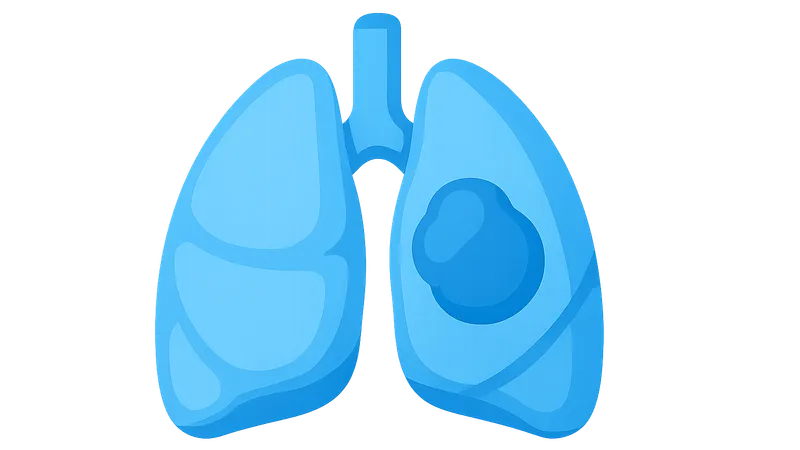 Mediastinal masses evaluation and management