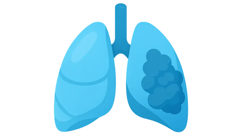 Chronic Respiratory Diseases