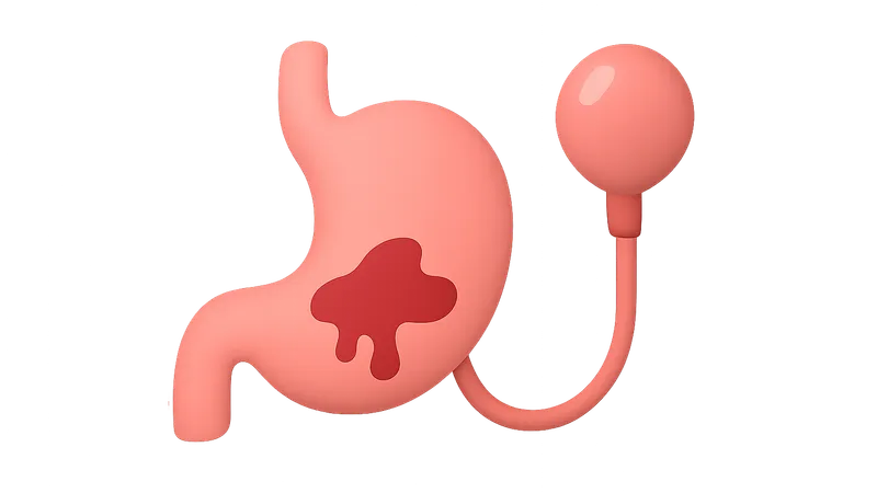 GI bleeding management