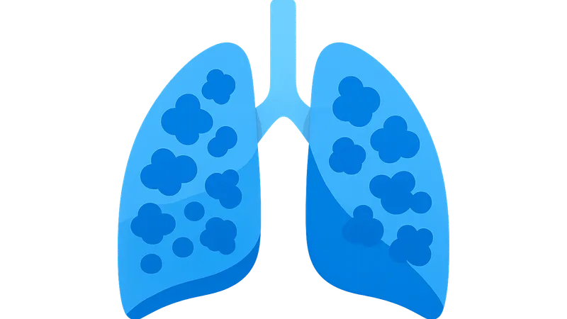 Hypersensitivity pneumonitis