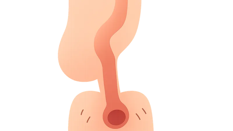 Anorectal Malformations