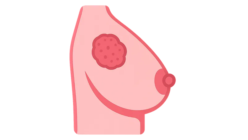 Breast cancer staging and surgical management