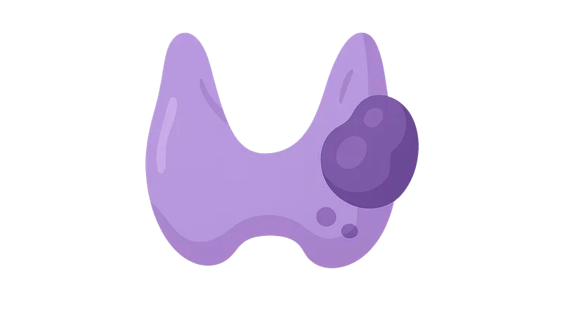 Thyroid nodules and cancer