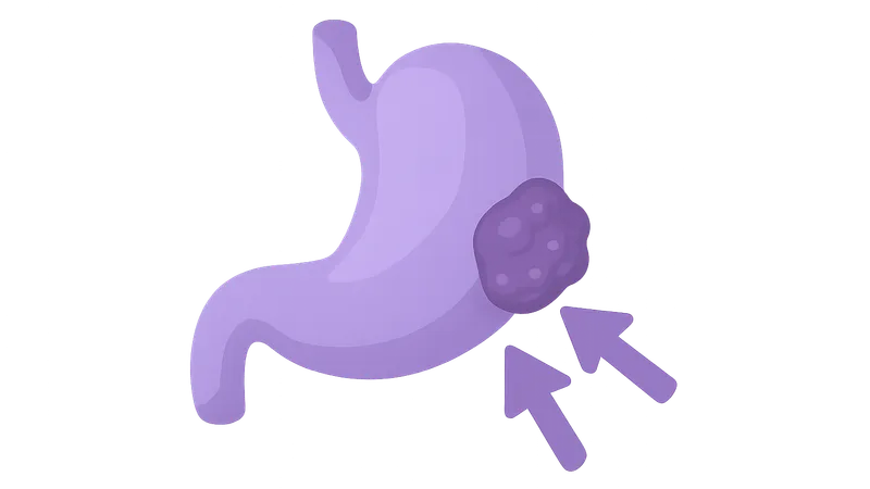 Neoadjuvant and adjuvant therapy timing