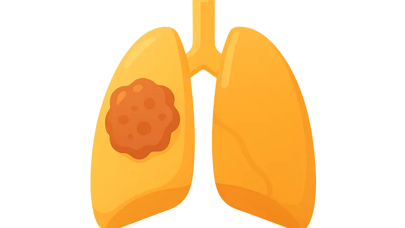 Occupational Cancers