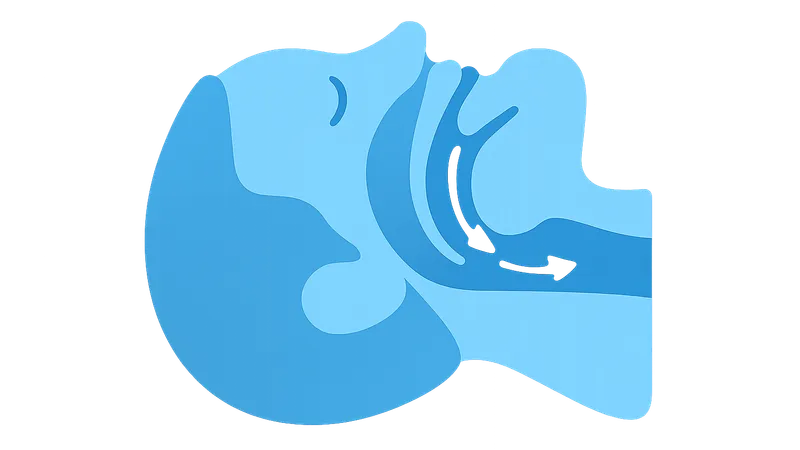 Pathophysiology of Sleep-Disordered Breathing