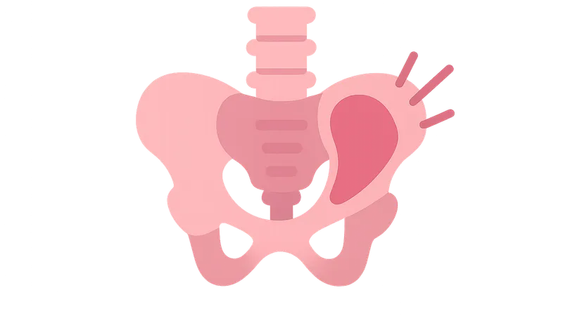 Musculoskeletal Causes of Pelvic Pain