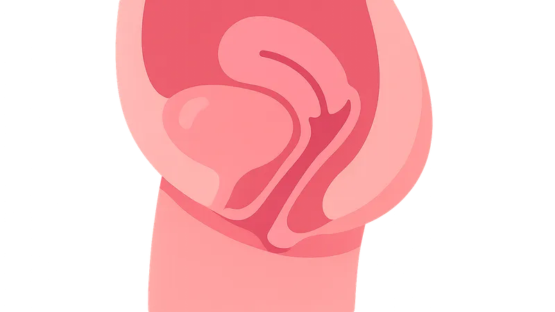 Cystocele and Urethrocele